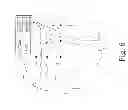 Fig. 07 - Customized patient-specific bone cutting blocks