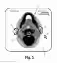 Fig. 04 - Integration of user inputs and correction of deformation vector field in deformable image registration workflow