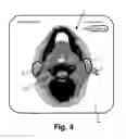 Fig. 05 - Integration of user inputs and correction of deformation vector field in deformable image registration workflow