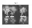 Fig. 02 - Reversible genic male sterility in compositae
