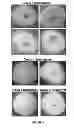 Fig. 04 - endophytes