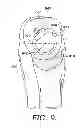 Fig. 06 - Optimal range of motion garment utilizing sleeve openings and gussets