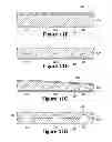 Fig. 12 - Ventilated And Protective Articles Of Apparel