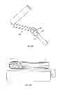 Fig. 22 - Collapsible Paint Roller Frame