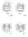 Fig. 02 - Fixation clip