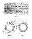 Fig. 02 - Methods for uniform crimping and deployment of a polymer scaffold