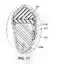 Fig. 15 - Protective member for an article of footwear