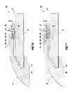 Fig. 07 - Attachment of wear member to lip of excavation implement