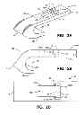 Fig. 04 - Coupling assemblies with enhanced take up