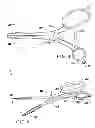 Fig. 03 - FISH MOUTH OPENING TOOL