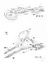 Fig. 04 - FISH MOUTH OPENING TOOL