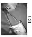 Fig. 05 - Fish tool