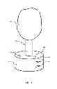 Fig. 02 - Methods and apparatuses for stabilizing trees against toppling forces