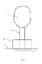 Fig. 03 - Methods and apparatuses for stabilizing trees against toppling forces