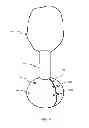 Fig. 05 - Methods and apparatuses for stabilizing trees against toppling forces