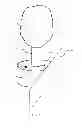 Fig. 06 - Methods and apparatuses for stabilizing trees against toppling forces