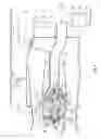 Fig. 02 - CONICAL LIGHT FOD MOMENTUM PARTICLE SEPARATOR PROTECTOR