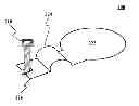 Fig. 01 - Methods of attaching a module on wafer substrate