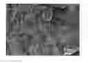 Fig. 01 - Rapid setting high strength calcium phosphate cements comprising cyclodextrins