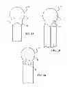 Fig. 07 - Piston and method of making a piston
