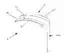 Fig. 01 - INTUBATION DEVICE