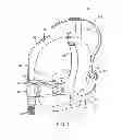 Fig. 02 - Patient interface device