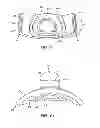 Fig. 09 - Patient interface device