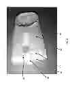 Fig. 04 - Exfoliating Foot Covering