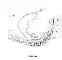 Fig. 06 - Hybrid drill bit and design method