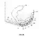 Fig. 07 - Hybrid drill bit and design method