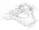 Fig. 01 - Brake caliper of a disk brake for a utility vehicle