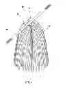 Fig. 04 - Cleaning structure for floating oil and substance on water surface