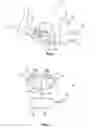 Fig. 02 - Portable dialysis device