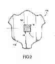 Fig. 08 - Railcar draft gear assembly and related method for assembling a railcar draft gear