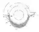 Fig. 01 - DEVICE FOR SELF-EXTRACTION OF VEHICLE