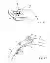 Fig. 07 - DEVICE FOR SELF-EXTRACTION OF VEHICLE