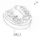 Fig. 06 - Multi-layer surgical guide