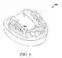 Fig. 07 - Multi-layer surgical guide
