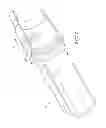 Fig. 02 - RESTRAINING SYSTEMS FOR BELLED PIPE