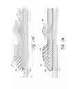 Fig. 27 - RESTRAINING SYSTEMS FOR BELLED PIPE