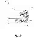 Fig. 08 - Flexible hinge and removable attachment