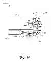Fig. 08 - Flexible hinge and removable attachment