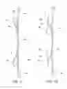 Fig. 07 - Spacer grids with springs having improved robustness