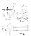 Fig. 02 - Delivery system for radiation therapy