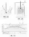 Fig. 09 - Delivery system for radiation therapy