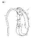 Fig. 02 - Hearing instrument housing having a plug-in connection, plug and hearing instrument