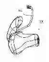 Fig. 01 - Method of manufacturing a soft custom ear mold and a soft custom ear mold