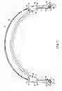Fig. 18 - Headband for personal speakers