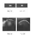 Fig. 07 - Image restoration system and method