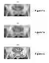 Fig. 08 - Method for interactive manual matching and real-time projection calculation in imaging